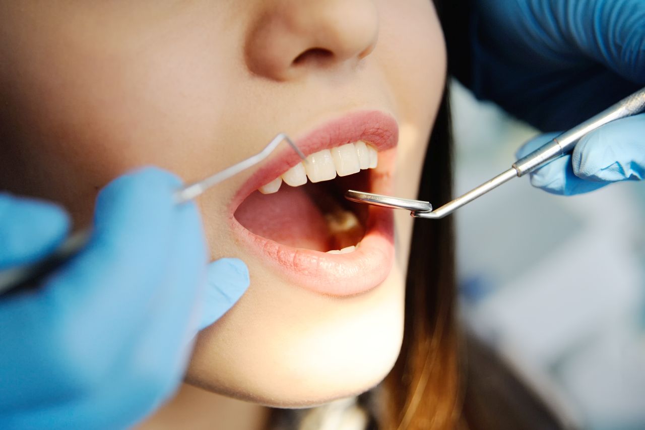 Kiedy należy poddać się leczeniu kanałowemu zęba?